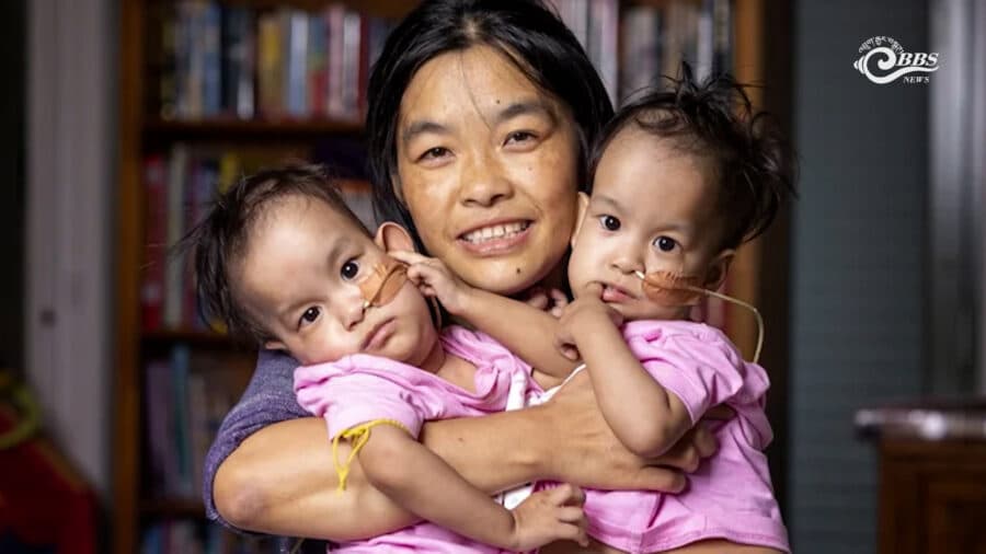 Eight years on, Bhutan’s first conjoined twins are growing into their own